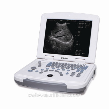 DW-500 laptop equipamentos médicos / preço de máquina de ultra-som portátil
